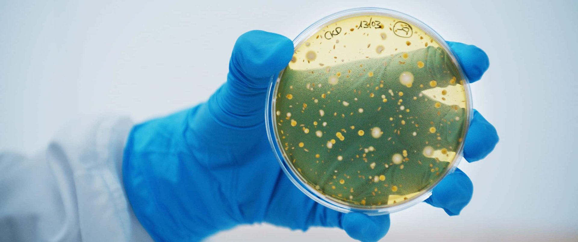 Scientific holding a laboratory dish with probiotics, analyzing its mechanisms of action