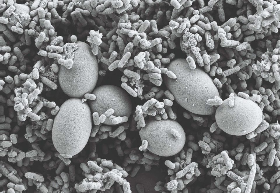 Probiotic strains from a microscopic view